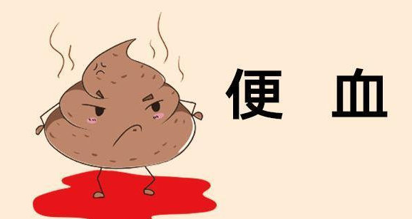 济南肛泰肛肠医院：大便时肛门出血怎么回事？为什么肛门会出血？