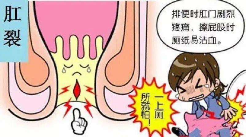 济南肛泰肛肠医院：肛门有裂口一直不好，反反复复怎么办？