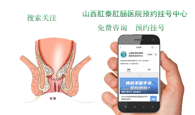 济南肛泰肛肠医院：肛裂一直不好，反反复复怎么办？