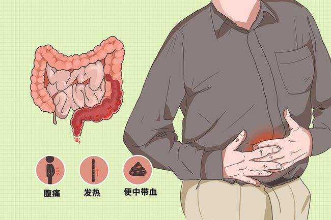济南肛泰肛肠医院：结肠炎的饮食有哪些需要注意的？