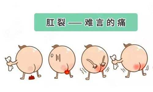 济南肛泰肛肠医院：肛裂从何而起？诱发肛裂的原因有哪些？